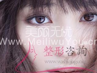 <a href=http://www.sbs17.com/listinfo-724-0.html target=_blank class=infotextkey>雙眼皮</a>修復(fù)術(shù)