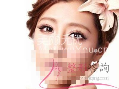 <a href=http://www.sbs17.com/listinfo-724-0.html target=_blank class=infotextkey>雙眼皮</a>,<a href=http://www.sbs17.com/listinfo-724-0.html target=_blank class=infotextkey>雙眼皮</a>整形手術(shù)