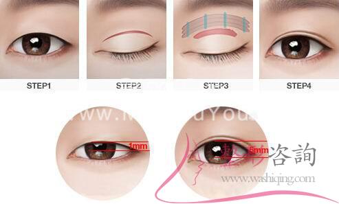 <a href=http://www.sbs17.com/listinfo-724-0.html target=_blank class=infotextkey>雙眼皮</a>術(shù)前設(shè)計(jì)方案：哪些形狀<a href=http://www.sbs17.com/listinfo-724-0.html target=_blank class=infotextkey>雙眼皮</a>好看