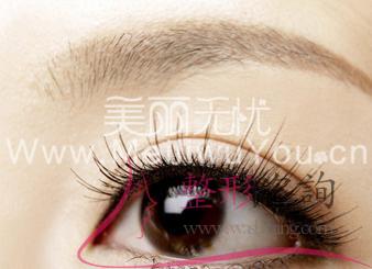 單眼皮,<a href=http://www.sbs17.com/listinfo-724-0.html target=_blank class=infotextkey>雙眼皮</a>