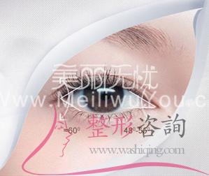 <a href=http://www.sbs17.com/listinfo-724-0.html target=_blank class=infotextkey>雙眼皮</a>