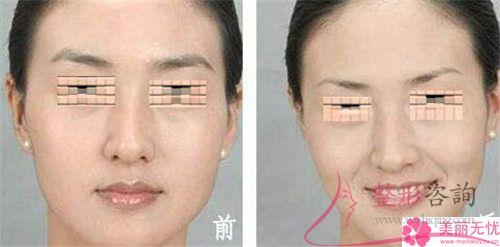 一次皮秒激光<a href=http://www.sbs17.com/listinfo-658-0.html target=_blank class=infotextkey>洗眉</a>能夠清潔凈紋眉嗎