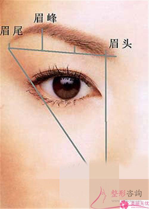 受術(shù)者是否能承擔(dān)實行種眉毛的價格