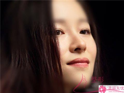 最好預(yù)備幾千塊就可實(shí)施抬高鼻梁