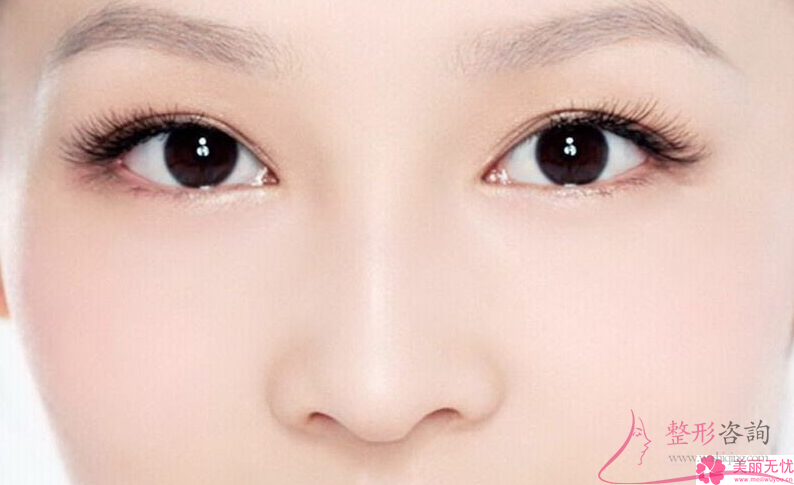 <a href=http://www.sbs17.com/listinfo-711-0.html target=_blank class=infotextkey>開眼角</a>得到的效果能夠持續(xù)25年嗎