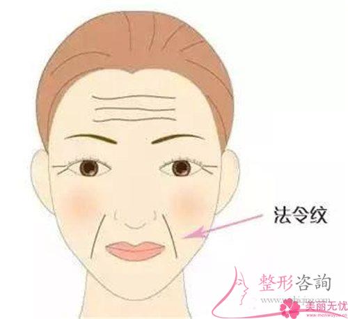 怎么樣徹底去除法令紋？指壓方法能<a href=http://www.sbs17.com/listinfo-780-0.html target=_blank class=infotextkey>去魚(yú)尾紋</a>嗎？