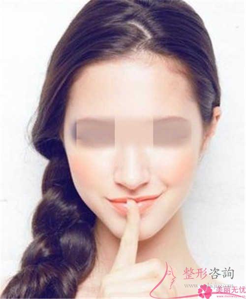 電波拉皮術(shù)后就能夠效果展現(xiàn)嗎？面部有些什么轉(zhuǎn)變呢