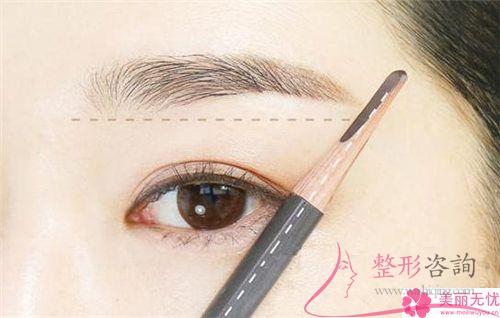 可以采用聚乙烯、聚四氟乙烯人工合成代品<a href=http://www.sbs17.com/listinfo-654-0.html target=_blank class=infotextkey>隆眉弓</a>嗎