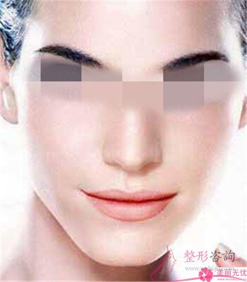 <a href=http://www.sbs17.com/listinfo-612-0.html target=_blank class=infotextkey>面部提升</a>適合哪些人群