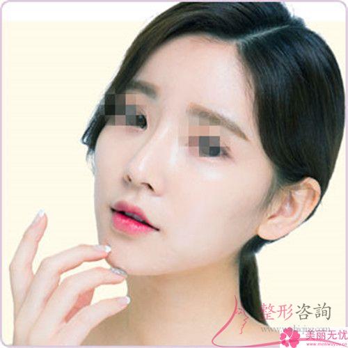 做<a href=http://www.sbs17.com/listinfo-744-0.html target=_blank class=infotextkey>鼻骨矯正</a>多長時(shí)間能做好？術(shù)后效果怎樣？