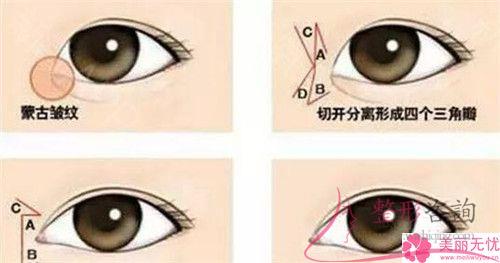 成都實(shí)施無(wú)痕<a href=http://www.sbs17.com/listinfo-711-0.html target=_blank class=infotextkey>開(kāi)眼角</a>術(shù)花多少錢？貴么