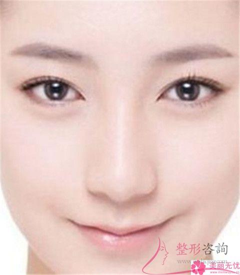 <a href=http://www.sbs17.com/listinfo-754-0.html target=_blank class=infotextkey>鼻翼</a>美容整形術(shù)方式都有哪幾種