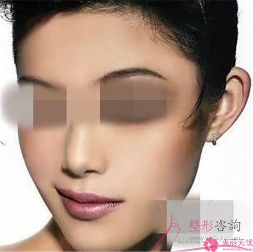 傷口沾水后不利于自體脂肪<a href=http://www.sbs17.com/listinfo-694-0.html target=_blank class=infotextkey>豐耳垂</a>后的恢復(fù)嗎