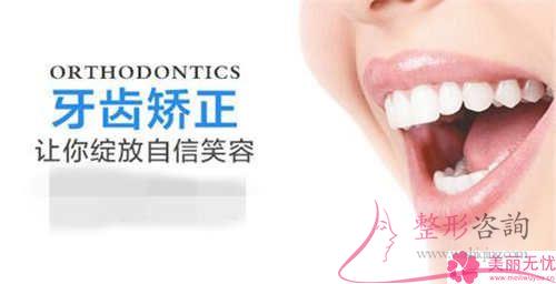 最科學(xué)的<a href=http://www.sbs17.com/listinfo-824-0.html target=_blank class=infotextkey>牙齒矯正</a>類型具體有哪些