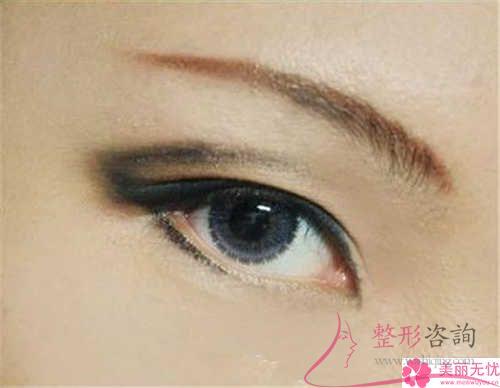 無(wú)痕翹睫法<a href=http://www.sbs17.com/listinfo-724-0.html target=_blank class=infotextkey>雙眼皮</a>多久能恢復(fù)自然