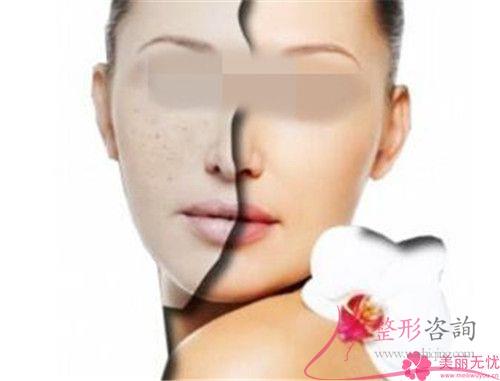 <a href=http://www.sbs17.com/listinfo-795-0.html target=_blank class=infotextkey>祛斑</a>大約費(fèi)用