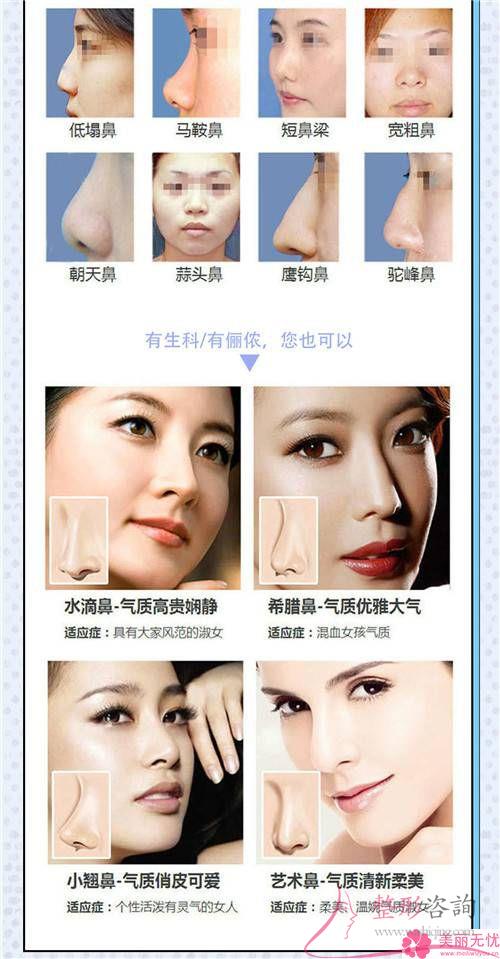 假體<a href=http://www.sbs17.com/listinfo-737-0.html target=_blank class=infotextkey>隆鼻</a>效果若何顯現(xiàn)呢
