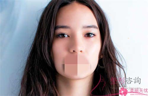 手術<a href=http://www.sbs17.com/listinfo-614-0.html target=_blank class=infotextkey>除皺</a>好久可以變得自然