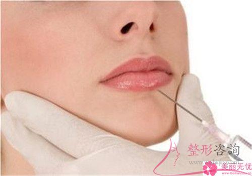 注射<a href=http://www.sbs17.com/listinfo-731-0.html target=_blank class=infotextkey>玻尿酸</a>豐唇（Hyaluronic acid enriches lips）到最后5877元夠不夠