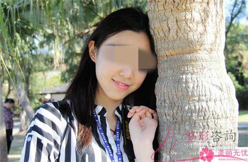 <a href=http://www.sbs17.com/listinfo-629-0.html target=_blank class=infotextkey>下頜角</a>整形手術(shù)哪一個項(xiàng)目美容效果好