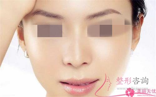<a href=http://www.sbs17.com/listinfo-737-0.html target=_blank class=infotextkey>隆鼻</a>手術(shù)后完全恢復(fù)需要花多久的時間