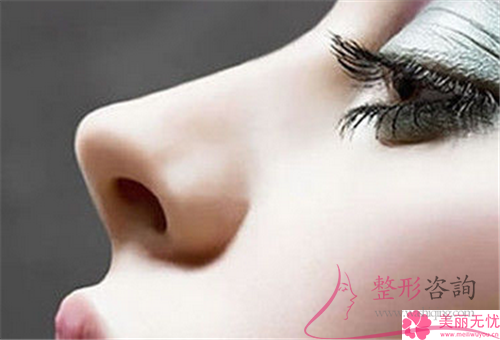 <a href=http://www.sbs17.com/listinfo-737-0.html target=_blank class=infotextkey>隆鼻</a>手術(shù)后完全恢復(fù)需要花多久的時間