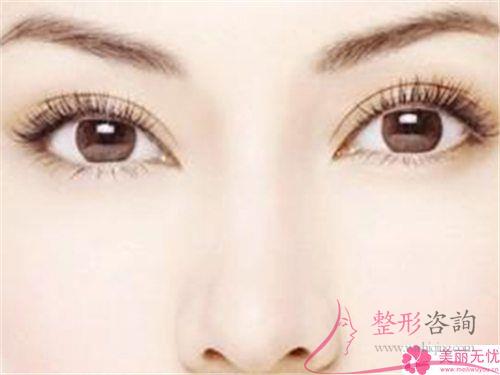 半切<a href=http://www.sbs17.com/listinfo-724-0.html target=_blank class=infotextkey>雙眼皮</a>手術(shù)合適哪些人群