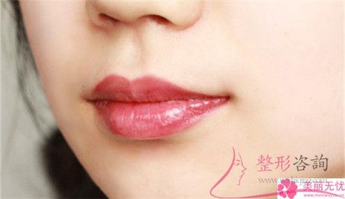 實(shí)施重唇修復(fù)手術(shù)有何手術(shù)風(fēng)險(xiǎn)嗎