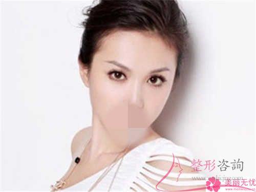 平常的<a href=http://www.sbs17.com/listinfo-614-0.html target=_blank class=infotextkey>除皺</a>成效,POP蛋白鋸齒線埋線懸吊<a href=http://www.sbs17.com/listinfo-614-0.html target=_blank class=infotextkey>除皺</a>是不是可以達(dá)到