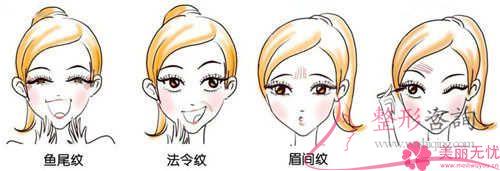 平常的<a href=http://www.sbs17.com/listinfo-614-0.html target=_blank class=infotextkey>除皺</a>抗衰成效,鋸齒線懸掛去皺方式能不能達(dá)到