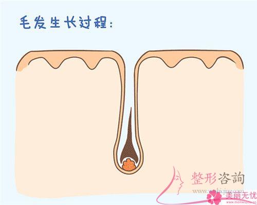 彩光<a href=http://www.sbs17.com/listinfo-670-0.html target=_blank class=infotextkey>脫毛</a>不成功到底怎么樣正確處理