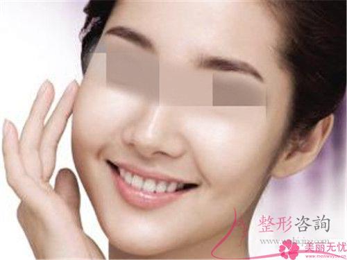 提拉面部哪個(gè)收入階層的美麗女性得以實(shí)行