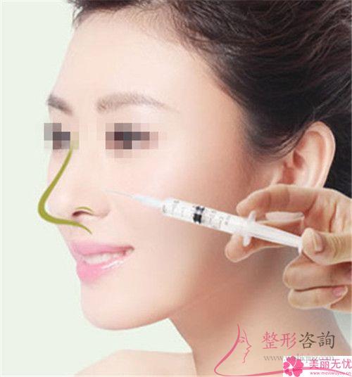 膨體聚四氟乙烯<a href=http://www.sbs17.com/listinfo-737-0.html target=_blank class=infotextkey>隆鼻</a>術靠譜嗎？是否有造成感染？