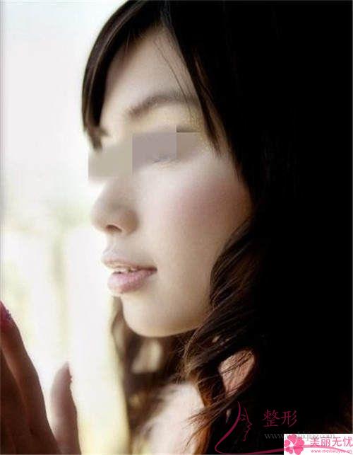 <a href=http://www.sbs17.com/listinfo-629-0.html target=_blank class=infotextkey>下頜角</a>截骨手術(shù)的費(fèi)用在12154-21849元之間嗎