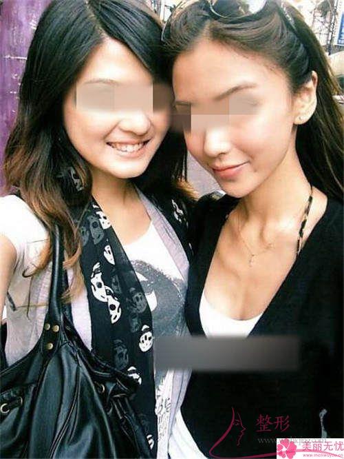 <a href=http://www.sbs17.com/listinfo-629-0.html target=_blank class=infotextkey>下頜角</a>截骨手術(shù)的費(fèi)用在12154-21849元之間嗎