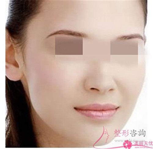 去正規(guī)的<a href=http://www.sbs17.com/listinfo-4-0.html target=_blank class=infotextkey>整形醫(yī)院</a>做<a href=http://www.sbs17.com/listinfo-731-0.html target=_blank class=infotextkey>玻尿酸</a>豐面頰手術(shù)安全嗎