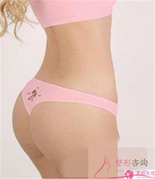 重慶花15489元可以完成自體脂肪<a href=http://www.sbs17.com/listinfo-677-0.html target=_blank class=infotextkey>豐臀</a>嗎