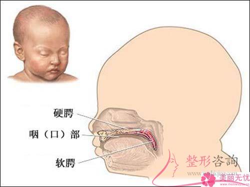 <a href=http://www.sbs17.com/listinfo-731-0.html target=_blank class=infotextkey>玻尿酸</a>注射豐嘴唇預(yù)測需要多少？
