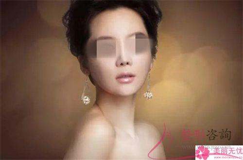 <a href=http://www.sbs17.com/listinfo-737-0.html target=_blank class=infotextkey>隆鼻</a>術(shù)整形效果有哪些