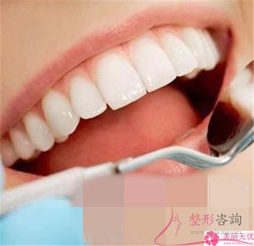 牙齒修復(fù)顆牙齒要準(zhǔn)備多少？
