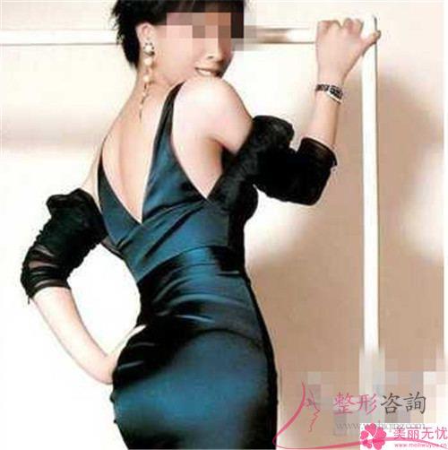 超聲臀部減脂的兩大優(yōu)勢(shì)