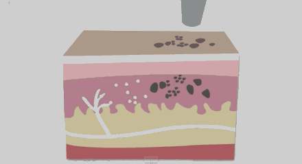 1106161390