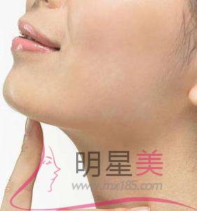 <a href=http://www.sbs17.com/listinfo-635-0.html target=_blank class=infotextkey>去頰脂墊</a>為什么沒效果
