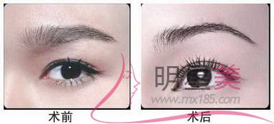 成都<a href=http://www.sbs17.com/listinfo-657-0.html target=_blank class=infotextkey>繡眉</a>哪里比較好