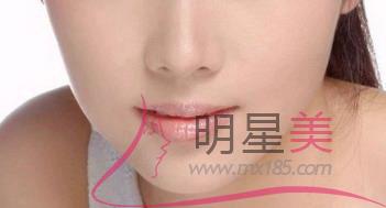 臉上下顎兩邊長(zhǎng)痘痘用什么藥