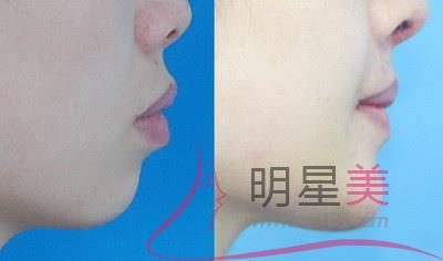 小孩子臉上好多小紅點(diǎn)