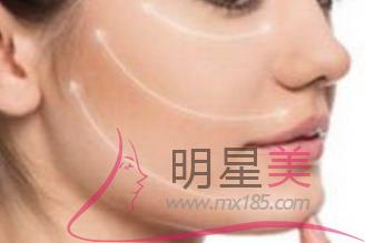 整容全臉價(jià)格