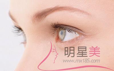 雙下巴<a href=http://www.sbs17.com/listinfo-685-0.html target=_blank class=infotextkey>吸脂</a>10天像沒吸一樣