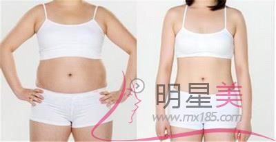 水動(dòng)力<a href=http://www.sbs17.com/listinfo-685-0.html target=_blank class=infotextkey>吸脂</a>手術(shù)的原理