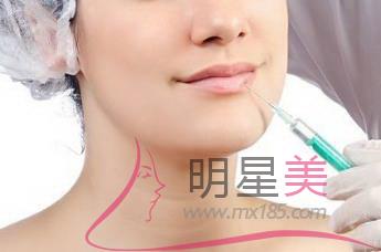 自體脂肪填下巴優(yōu)缺點(diǎn)